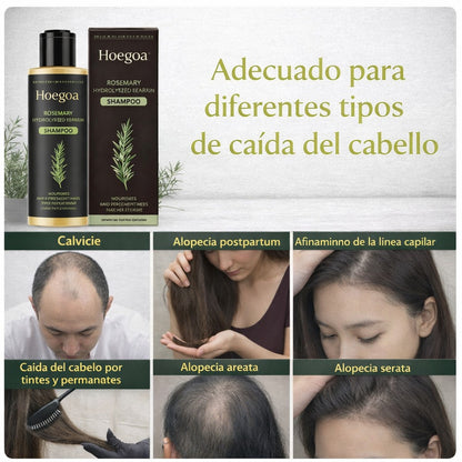 Shampoo de Romero | Detén la caída y activa el crecimiento de tu cabello